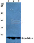 Synuclein-α (E123) polyclonal antibody – Figure 1 of 1