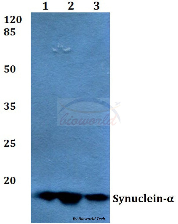 Synuclein-α (E123) polyclonal antibody – Figure 1 of 1
