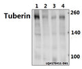 Western blot (WB) analysis of Tuberin (F933) polyclonal antibody at 1:500 dilution
Lane1:C6 whole cell lysate(40ug)
Lane2:MEF whole cell lysate(40ug)
Lane3:A549 whole cell lysate(40ug)
Lane4:L02 whole cell lysate(40ug)