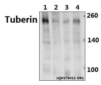 Western blot (WB) analysis of Tuberin (F933) polyclonal antibody at 1:500 dilution
Lane1:C6 whole cell lysate(40ug)
Lane2:MEF whole cell lysate(40ug)
Lane3:A549 whole cell lysate(40ug)
Lane4:L02 whole cell lysate(40ug)