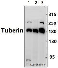 Western blot (WB) analysis of Tuberin (L1456) polyclonal antibody at 1:2000 dilution
Lane3:THP-1 whole cell lysate(40ug)
Lane4:K562 whole cell lysate(40ug)
Lane5:PC3 whole cell lysate(40ug)