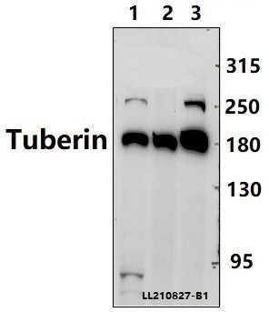 Western blot (WB) analysis of Tuberin (L1456) polyclonal antibody at 1:2000 dilution
Lane3:THP-1 whole cell lysate(40ug)
Lane4:K562 whole cell lysate(40ug)
Lane5:PC3 whole cell lysate(40ug)
