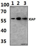 Western blot (WB) analysis of XIAP (G81) polyclonal antibody at 1:500 dilution
Lane1:Hela whole cell lysate(40ug)
Lane2:Hela treated with H2O2 (100nmol/ml, 25min, phostop) whole cell lysate (40ug)
Lane3:Hela treated with H2O2 (100nmol/ml, 25min, λ-ppase) whole cell lysate (40ug)