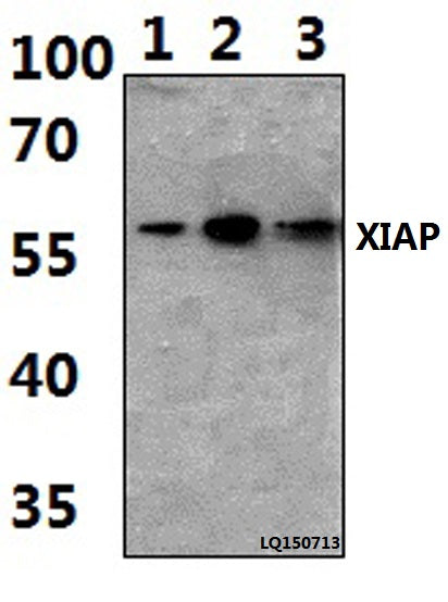 Western blot (WB) analysis of XIAP (G81) polyclonal antibody at 1:500 dilution
Lane1:Hela whole cell lysate(40ug)
Lane2:Hela treated with H2O2 (100nmol/ml, 25min, phostop) whole cell lysate (40ug)
Lane3:Hela treated with H2O2 (100nmol/ml, 25min, λ-ppase) whole cell lysate (40ug)