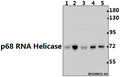 Western blot (WB) analysis of p68 RNA Helicase (N589) pAb at 1:500 dilution
Lane1:PC12 whole cell lysate(40ug)
Lane2:3T3-L1 whole cell lysate(40ug)
Lane3:Panc1 whole cell lysate(40ug)
Lane4:MCF-7 whole cell lysate(40ug)
Lane5:Hela whole cell lysate(40ug)