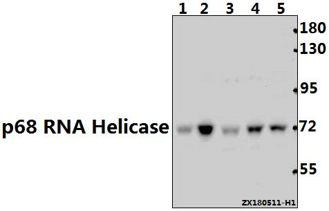 Western blot (WB) analysis of p68 RNA Helicase (N589) pAb at 1:500 dilution
Lane1:PC12 whole cell lysate(40ug)
Lane2:3T3-L1 whole cell lysate(40ug)
Lane3:Panc1 whole cell lysate(40ug)
Lane4:MCF-7 whole cell lysate(40ug)
Lane5:Hela whole cell lysate(40ug)
