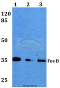 Western blot (WB) analysis of Fos B (S23) polyclonal antibody at 1:500 dilution
Lane1:HEK293T whole cell lysate
Lane2:sp2/0 whole cell lysate
Lane3:PC12 whole cell lysate