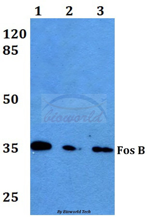 Western blot (WB) analysis of Fos B (S23) polyclonal antibody at 1:500 dilution
Lane1:HEK293T whole cell lysate
Lane2:sp2/0 whole cell lysate
Lane3:PC12 whole cell lysate