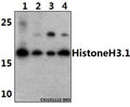 Western blot (WB) analysis of Histone H3 polyclonal antibody at 1:1000 dilution
Lane1:Hela whole cell lysate(40ug)
Lane2:HEK293T whole cell lysate(40ug)
Lane3:A549 whole cell lysate(40ug)
Lane4:CT-26 whole cell lysate(40ug)
Lane5:C6 whole cell lysate(40ug)