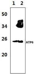 Western blot (WB) analysis of ATP6 polyclonal antibody at 1:1000 dilution
Lane1:The muscle tissue lysate of Rat (47μg)
Lane2:The muscle tissue lysate of Mouse(37μg)