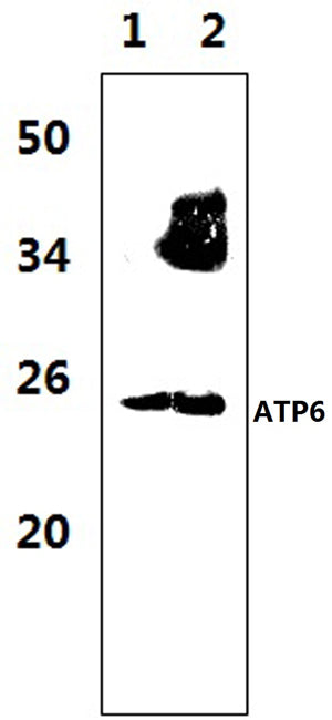 Western blot (WB) analysis of ATP6 polyclonal antibody at 1:1000 dilution
Lane1:The muscle tissue lysate of Rat (47μg)
Lane2:The muscle tissue lysate of Mouse(37μg)