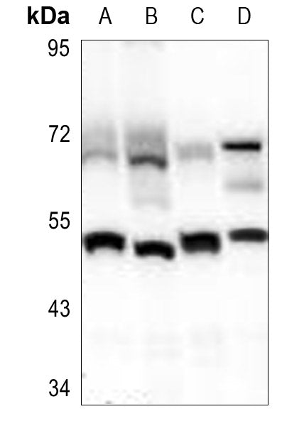 Western blot (WB) analysis of PPAR-α (G17) pAb at 1:500 dilution
Lane1:HepG2 whole cell lysate(40ug)
Lane2:HEK293T whole cell lysate(40ug)
Lane3:THP-1 whole cell lysate(40ug)
Lane4:AML-12 whole cell lysate(40ug)