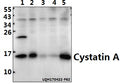 Western blot (WB) analysis of Cystatin A (G84) polyclonal antibody at 1:500 dilution
Lane1:PC12 whole cell lysate(40ug)
Lane2:CT-26 whole cell lysate(40ug)
Lane3:COS-7 whole cell lysate(40ug)
Lane4:HEK293T whole cell lysate(40ug)
Lane5:Beas-2B whole cell lysate(40ug)