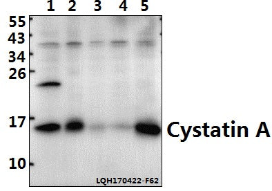 Western blot (WB) analysis of Cystatin A (G84) polyclonal antibody at 1:500 dilution
Lane1:PC12 whole cell lysate(40ug)
Lane2:CT-26 whole cell lysate(40ug)
Lane3:COS-7 whole cell lysate(40ug)
Lane4:HEK293T whole cell lysate(40ug)
Lane5:Beas-2B whole cell lysate(40ug)