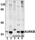 Western blot (WB) analysis of AURKB (Y8) polyclonal antibody at 1:500 dilution
Lane1:HEK293T whole cell lysate(40ug)
Lane2:AML-12 whole cell lysate(40ug)
Lane3:PC12 whole cell lysate(40ug)
Lane4:Jurkat whole cell lysate(40ug)
Lane5:THP-1 whole cell lysate(40ug)