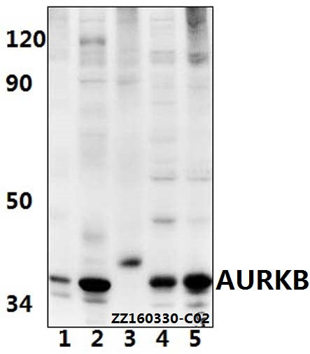 Western blot (WB) analysis of AURKB (Y8) polyclonal antibody at 1:500 dilution
Lane1:HEK293T whole cell lysate(40ug)
Lane2:AML-12 whole cell lysate(40ug)
Lane3:PC12 whole cell lysate(40ug)
Lane4:Jurkat whole cell lysate(40ug)
Lane5:THP-1 whole cell lysate(40ug)