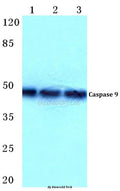 Western blot (WB) analysis of Caspase 9 (R192) polyclonal antibody at 1:500 dilution
Lane1:Hela cell lysate
Lane2:sp2/0 cell lysate
Lane3:H9C2 cell lysate