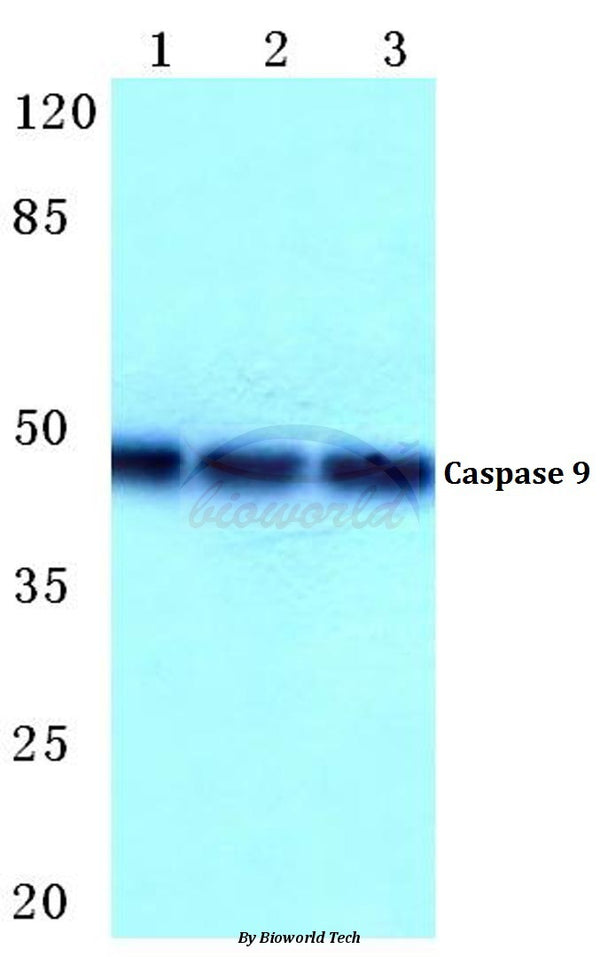 Western blot (WB) analysis of Caspase 9 (R192) polyclonal antibody at 1:500 dilution
Lane1:Hela cell lysate
Lane2:sp2/0 cell lysate
Lane3:H9C2 cell lysate