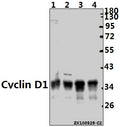 Western blot (WB) analysis of Cyclin D1 (L283) pAb at 1:2000 dilution
Lane1:HepG2 whole cell lysate(20ug)
Lane2:L02 whole cell lysate(20ug)
Lane3:C6 whole cell lysate(20ug)
Lane4:3T3-L1 whole cell lysate(20ug)