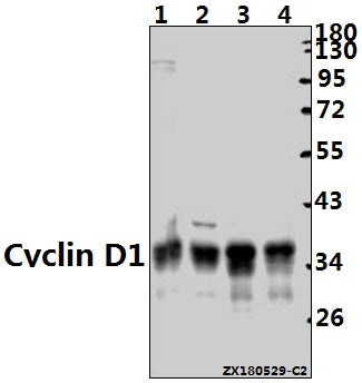 Western blot (WB) analysis of Cyclin D1 (L283) pAb at 1:2000 dilution
Lane1:HepG2 whole cell lysate(20ug)
Lane2:L02 whole cell lysate(20ug)
Lane3:C6 whole cell lysate(20ug)
Lane4:3T3-L1 whole cell lysate(20ug)