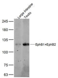 Sample:
Large intestine (Mouse) Lysate at 40 ug
Testis (Mouse) Lysate at 40 ug
Primary: Anti-EphB1/2 at 1/300 dilution