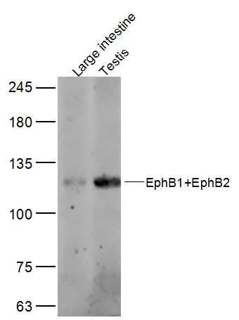 Sample:
Large intestine (Mouse) Lysate at 40 ug
Testis (Mouse) Lysate at 40 ug
Primary: Anti-EphB1/2 at 1/300 dilution