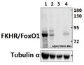 Western blot (WB) analysis of FKHR/FoxO1 (T323) polyclonal antibody at 1:500 dilution
Lane1:PC12 whole cell lysate(40ug)
Lane2:BV2 whole cell lysate(40ug)
Lane3:A549 whole cell lysate(40ug)
Lane4:HEK293T whole cell lysate(40ug)