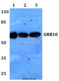GRB10 (L63) polyclonal antibody – Figure 1 of 1
