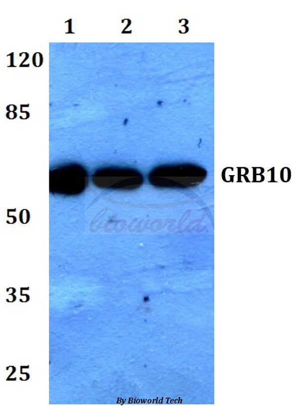 GRB10 (L63) polyclonal antibody – Figure 1 of 1