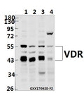 Western blot (WB) analysis of VDR (N204) pAb at 1:500 dilution
Lane1:K562 whole cell lysate(40ug)
Lane2:HCT116 whole cell lysate(40ug)
Lane3:3T3-L1 whole cell lysate(40ug)
Lane4:The Kidney tissue lysate of Rat(40ug)