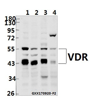 Western blot (WB) analysis of VDR (N204) pAb at 1:500 dilution
Lane1:K562 whole cell lysate(40ug)
Lane2:HCT116 whole cell lysate(40ug)
Lane3:3T3-L1 whole cell lysate(40ug)
Lane4:The Kidney tissue lysate of Rat(40ug)