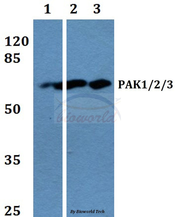 Western blot (WB) analysis of PAK1/2/3 (K140) polyclonal antibody at 1:500 dilution
Lane1:HEK293T whole cell lysate
Lane2:Mouse liver tissue lysae
Lane3:PC12 whole cell lysate