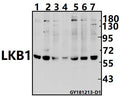 Western blot (WB) analysis of LKB1 (R425) pAb at 1:1000 dilution
Lane1:MCF-7 whole cell lysate(40ug)
Lane2:H9C2 whole cell lysate(40ug)
Lane3:PMVEC whole cell lysate(40ug)
Lane4:The Testis tissue lysate of Mouse (40ug)
Lane5:EC9706 whole cell lysate(40ug)
Lane6:H1792 whole cell lysate(40ug)
Lane7:SK-OVCAR3 whole cell lysate(40ug)
