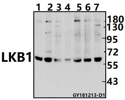 Western blot (WB) analysis of LKB1 (R425) pAb at 1:1000 dilution
Lane1:MCF-7 whole cell lysate(40ug)
Lane2:H9C2 whole cell lysate(40ug)
Lane3:PMVEC whole cell lysate(40ug)
Lane4:The Testis tissue lysate of Mouse (40ug)
Lane5:EC9706 whole cell lysate(40ug)
Lane6:H1792 whole cell lysate(40ug)
Lane7:SK-OVCAR3 whole cell lysate(40ug)