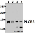 Western blot (WB) analysis of PLCB3 pAb at 1:500 dilution
Lane1:HCT116 whole cell lysate(40ug)
Lane2:Beas-2B whole cell lysate(40ug)
Lane3:PMVEC whole cell lysate(40ug)
Lane4:CT26 whole cell lysate(40ug)