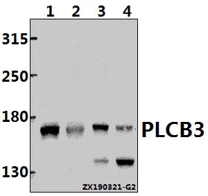 Western blot (WB) analysis of PLCB3 pAb at 1:500 dilution
Lane1:HCT116 whole cell lysate(40ug)
Lane2:Beas-2B whole cell lysate(40ug)
Lane3:PMVEC whole cell lysate(40ug)
Lane4:CT26 whole cell lysate(40ug)