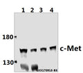 Western blot (WB) analysis of c-Met (E999) pAb at 1:500 dilution
Lane1:HEK293T whole cell lysate(40ug)
Lane2:A375 whole cell lysate(40ug)
Lane3:SGC7901 whole cell lysate(40ug)
Lane4:SK-OVCAR3 whole cell lysate(40ug)