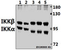 Western blot (WB) analysis of IKKα/β (D173) pAb at 1:500 dilution
Lane1:MEF whole cell lysate(40ug)
Lane2:H9C2 whole cell lysate(40ug)
Lane3:Panc1 whole cell lysate(40ug)
Lane4:PC3 whole cell lysate(40ug)
Lane5:Jurkat whole cell lysate(40ug)