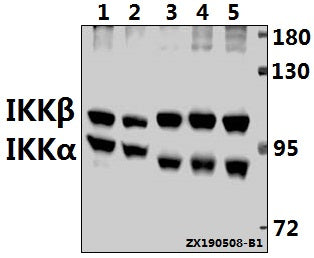 Western blot (WB) analysis of IKKα/β (D173) pAb at 1:500 dilution
Lane1:MEF whole cell lysate(40ug)
Lane2:H9C2 whole cell lysate(40ug)
Lane3:Panc1 whole cell lysate(40ug)
Lane4:PC3 whole cell lysate(40ug)
Lane5:Jurkat whole cell lysate(40ug)