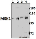 Western blot (WB) analysis of MSK1 (Q577) pAb at 1:500 dilution
Lane1:C6 whole cell lysate(40ug)
Lane2:AML-12 whole cell lysate(40ug)
Lane3:A2780 whole cell lysate(40ug)
Lane4:HEK293T whole cell lysate(40ug)