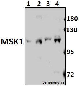 Western blot (WB) analysis of MSK1 (Q577) pAb at 1:500 dilution
Lane1:C6 whole cell lysate(40ug)
Lane2:AML-12 whole cell lysate(40ug)
Lane3:A2780 whole cell lysate(40ug)
Lane4:HEK293T whole cell lysate(40ug)