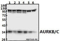 Western blot (WB) analysis of AURKB/C (K197) pAb at 1:500 dilution
Lane1:HEK293T whole cell lysate(20ug)
Lane2:HepG2 whole cell lysate(20ug)
Lane3:PC3 whole cell lysate(40ug)
Lane4:A549 whole cell lysate(40ug)
Lane5:PC12 whole cell lysate(40ug)
Lane6:AML-12 whole cell lysate(40ug)