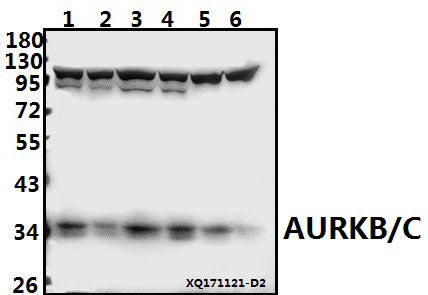 Western blot (WB) analysis of AURKB/C (K197) pAb at 1:500 dilution
Lane1:HEK293T whole cell lysate(20ug)
Lane2:HepG2 whole cell lysate(20ug)
Lane3:PC3 whole cell lysate(40ug)
Lane4:A549 whole cell lysate(40ug)
Lane5:PC12 whole cell lysate(40ug)
Lane6:AML-12 whole cell lysate(40ug)