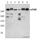 Western blot (WB) analysis of mTOR (S2442) at 1:500 dillution
Lane1:NIH-3T3 whole cell lysate(40μg)
Lane2:HEK293T whole cell lysate(40μg)
Lane3:H9C2 whole cell lysate(40μg)
Lane4:Hela whole cell lysate(40μg)
Lane5:MCF-7 whole cell lysate(40μg)
Lane6:HepG2 whole cell lysate(40μg)