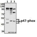 Western blot (WB) analysis of p47-phox (P300) pAb at 1:500 dilution
Lane1:PMVEC whole cell lysate(40ug)
Lane2:Jurkat whole cell lysate(40ug)
Lane3:The Lung tissue lysate of Mouse(40ug)
