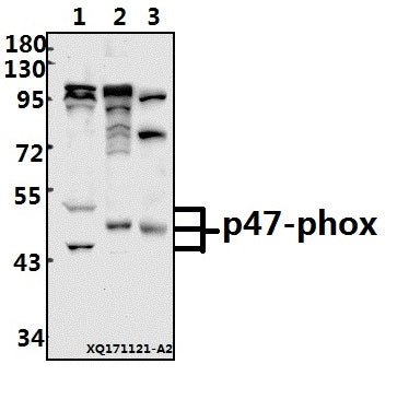 Western blot (WB) analysis of p47-phox (P300) pAb at 1:500 dilution
Lane1:PMVEC whole cell lysate(40ug)
Lane2:Jurkat whole cell lysate(40ug)
Lane3:The Lung tissue lysate of Mouse(40ug)