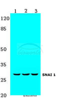 Western blot (WB) analysis of Snail1 (A242) polyclonal antibody at 1:500 dilution
Lane1:MCF-7 cell lysate
Lane2:NIH-3T3 cell lysate
Lane3:Rat heart tissue lysate