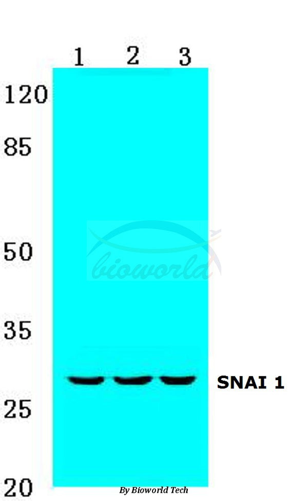 Western blot (WB) analysis of Snail1 (A242) polyclonal antibody at 1:500 dilution
Lane1:MCF-7 cell lysate
Lane2:NIH-3T3 cell lysate
Lane3:Rat heart tissue lysate