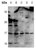 Western blot analysis of TNF-α expression in HEK293T (A), Hela (B), mouse lung (C), mouse kidney (D), mouse spleen (E) whole cell lysates.