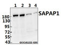 Western blot (WB) analysis of SAPAP1 (E817) polyclonal antibody at 1:500 dilution
Lane1:The Brain tissue lysate of Mouse(40ug)
Lane2:The Brain tissue lysate of Rat(40ug)
Lane3:U-87MG whole cell lysate(40ug)
Lane4:U-251MG whole cell lysate(40ug)